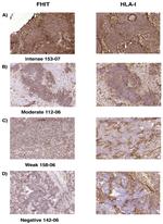 FHIT Antibody in Immunohistochemistry (IHC)