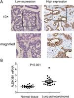 ALDH3B1 Antibody in Immunohistochemistry (IHC)