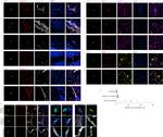 CD31 Antibody in Immunohistochemistry (IHC)