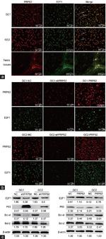 PRPS2 Antibody in Immunocytochemistry (ICC/IF)