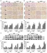 FIS1 Antibody in Western Blot, Immunohistochemistry (WB, IHC)