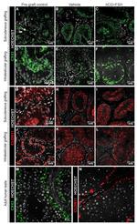 Claudin 11 Antibody in Immunohistochemistry (IHC)