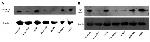 ANKRD17 Antibody in Western Blot (WB)