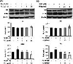 IDE Antibody in Western Blot (WB)