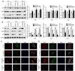 SFTPC Antibody in Western Blot, Immunocytochemistry (WB, ICC/IF)