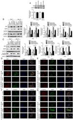 SFTPC Antibody in Western Blot, Immunocytochemistry (WB, ICC/IF)