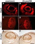 PITX3 Antibody in Immunohistochemistry (IHC)