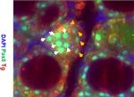 PAX8 Antibody in Immunohistochemistry (IHC)