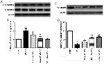 VE-cadherin Antibody in Western Blot (WB)