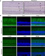 Cytokeratin 14 Antibody in Immunohistochemistry (IHC)