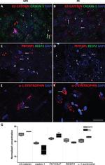 REEP2 Antibody in Immunohistochemistry (IHC)