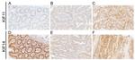 KIF11 Antibody in Immunohistochemistry (IHC)