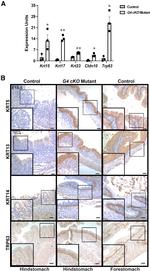 Cytokeratin 14 Antibody in Immunohistochemistry (IHC)