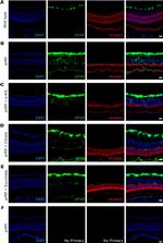 S-arrestin Antibody in Immunohistochemistry (IHC)