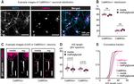 CaMKII alpha Antibody in Immunocytochemistry (ICC/IF)