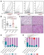 Carbonic Anhydrase IX Antibody in Immunohistochemistry (IHC)