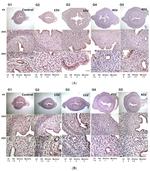 Estrogen Receptor alpha Antibody in Immunohistochemistry (IHC)