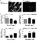 Fibronectin Antibody in Immunohistochemistry (IHC)