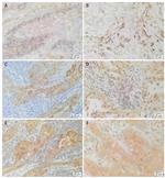 SOX2 Antibody in Immunohistochemistry (IHC)