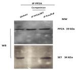 SET Antibody in Western Blot (WB)