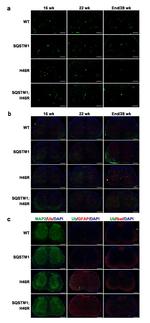 SQSTM1 Antibody in Immunocytochemistry (ICC/IF)