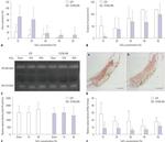 Factor XIII A Antibody in Immunohistochemistry (IHC)