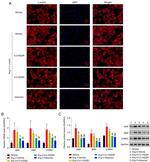 Cardiac Myosin Heavy Chain Antibody in Western Blot (WB)