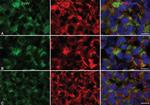 Prolactin Antibody in Immunohistochemistry (IHC)