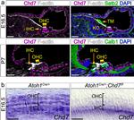 CHD7 Antibody in Immunohistochemistry (IHC)