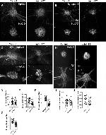 HuD Antibody in Immunohistochemistry (IHC)