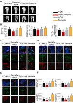 Leptin Receptor Antibody in Immunohistochemistry (IHC)