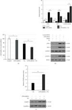 MLKL Antibody in Western Blot (WB)