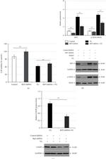 MLKL Antibody in Western Blot (WB)