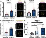 LOXL2 Antibody in Immunocytochemistry (ICC/IF)