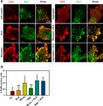 IBA1 Antibody in Immunocytochemistry (ICC/IF)