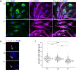 EML1 Antibody in Immunocytochemistry (ICC/IF)