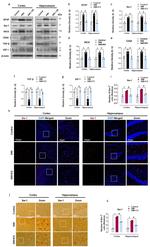 IBA1 Antibody in Immunohistochemistry (IHC)