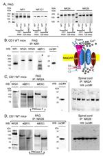 NMDAR2B Antibody in Western Blot (WB)