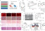 PRDM16 Antibody in Western Blot (WB)