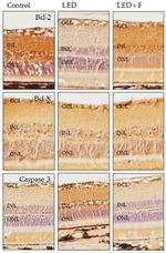 Bcl-2 Antibody in Immunohistochemistry (IHC)