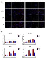 Ferritin Light Chain Antibody in Immunocytochemistry (ICC/IF)