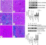 Acetyl-SMAD2/SMAD3 (Lys19) Antibody in Western Blot (WB)