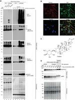 ATP1A3 Antibody in Western Blot (WB)