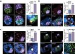 Optineurin Antibody in Immunocytochemistry (ICC/IF)