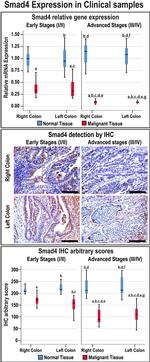 SMAD4 Antibody in Immunohistochemistry (IHC)