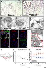 VE-cadherin Antibody in Immunohistochemistry (IHC)