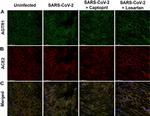 AGTR1 Antibody in Immunocytochemistry (ICC/IF)