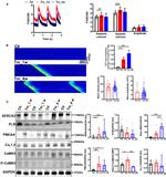 PMCA4 ATPase Antibody in Western Blot (WB)