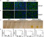 BSEP Antibody in Immunohistochemistry (IHC)