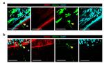 Nestin Antibody in Immunohistochemistry (IHC)